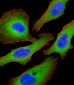 Tuberin (TSC2) Antibody (S1798)